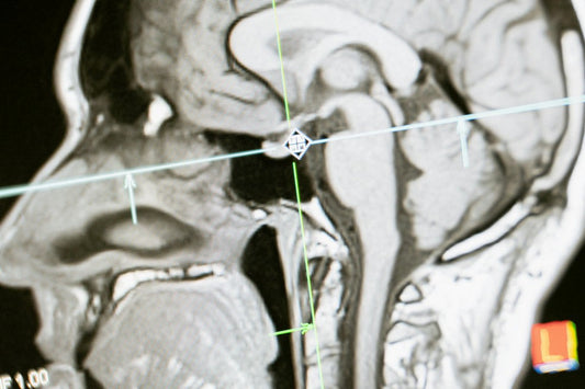 Neurotherapy - How Good Is It?