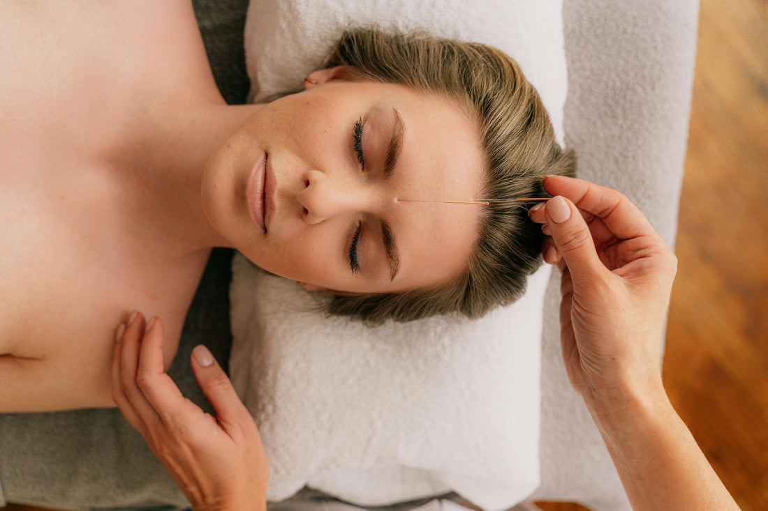 Acupuncture - What Is It?